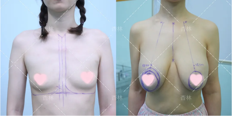 1747125706387028.png image.png